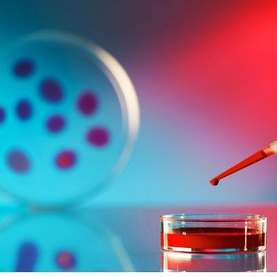 肾上腺素具体作用有哪些