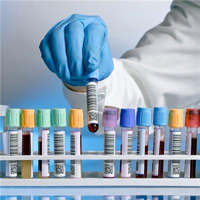 血液检查能查出什么