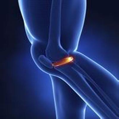 膝关节髁间棘变尖怎么回事