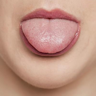 舌头上长肉芽是怎么回事