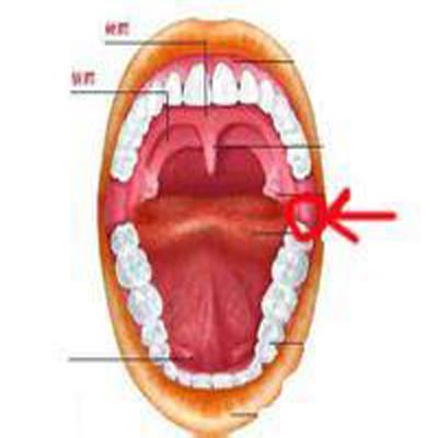 口腔内壁肿痛怎么办