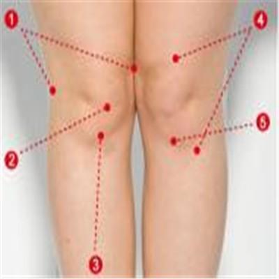 髋关节滑膜炎的症状有哪些？