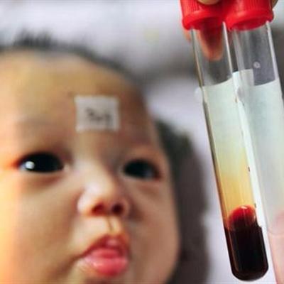 轻度乳糜血检查什么项目