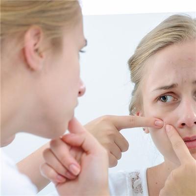 嘴巴周围长痘的原因有哪些