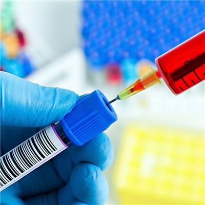 总胆汁酸高说明什么