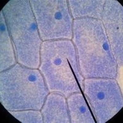 上皮细胞2+是什么