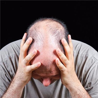 头发掉的厉害吃什么能改善