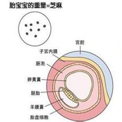 怀孕染色体检查什么