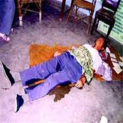 大便失禁怎么治疗