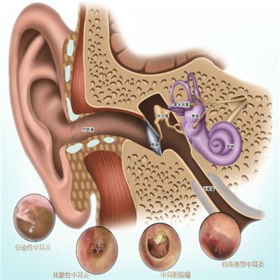 上耳根疼是怎么回事