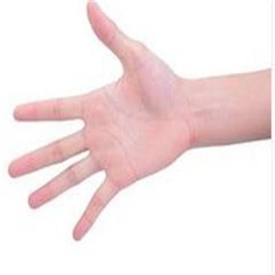 手掌有红点怎么回事