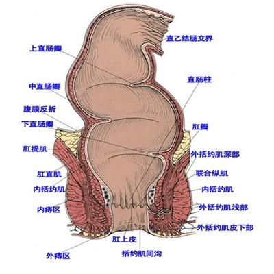 得了难言的肛周炎症该怎么办