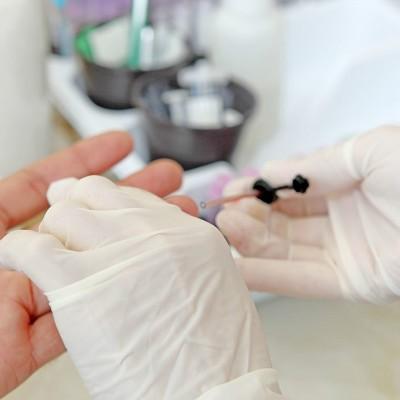 检查艾滋病需要多少钱