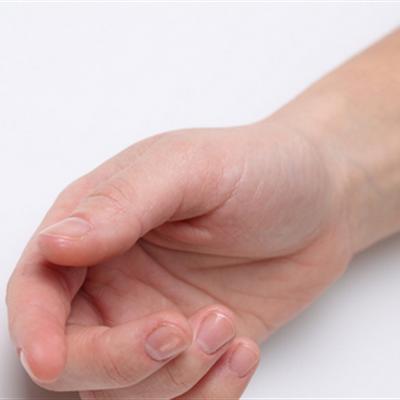 手上湿疹的治疗方法