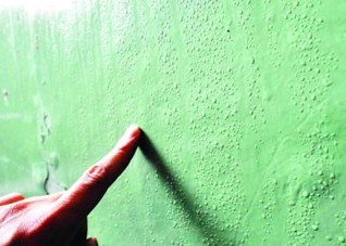 皮肤患上湿疹要怎么治疗？