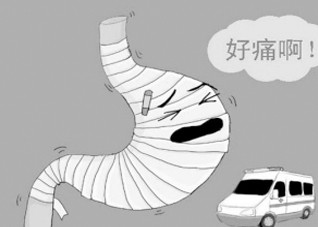 如何治疗急性胃炎