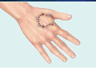 狂犬病有哪些表现及如何诊断?