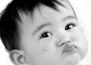 湿疹是什么因素造成的