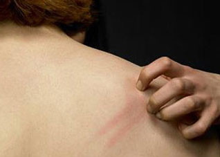 谨防三大皮肤异常症状