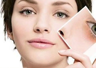 防晒按摩法祛除雀斑