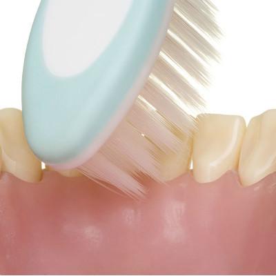 牙龈经常出血是什么原因?