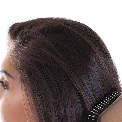 女孩子脱发很厉害是什么原因啊?