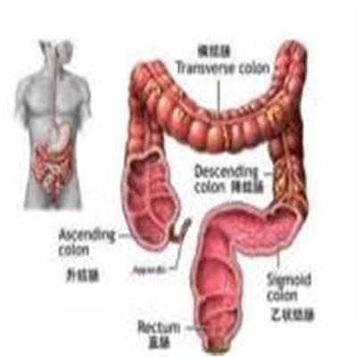 升结肠癌能治愈吗