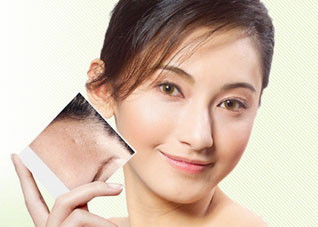 除痘战术的错误做法是什么