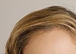 核桃花粉过敏怎么办 核桃花粉过敏怎么办呢