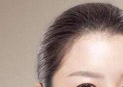 黄褐斑要怎么调理 黄褐斑要怎么调理才能好不会反弹