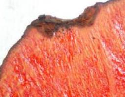 血茯苓的功效与作用及禁忌（茯苓的功效及禁忌症）