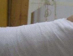 八仙接骨宝的配方与功效 八仙接骨宝成分功效