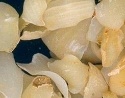 常吃百合的功效与作用 常吃百合有什么功效