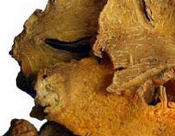 中药射干的功效与作用（中药射干的功效与作用射干与夏枯草）