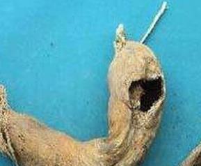 枯萝卜水的功效与作用（多喝枯萝卜的作用）