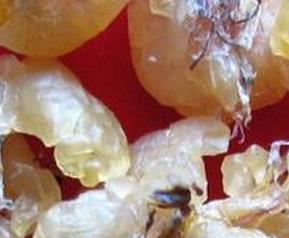 林蛙油的食用方法