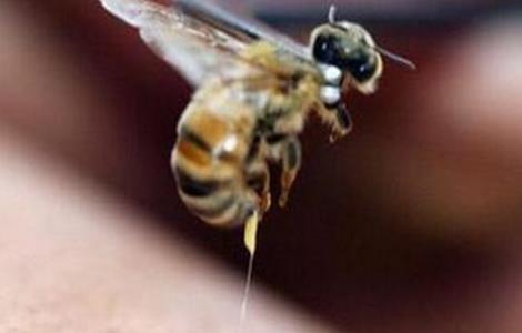 被蜜蜂蜇了该怎么办 被蜜蜂蛰了该怎么办该怎么治