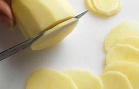 土豆面膜能祛斑吗