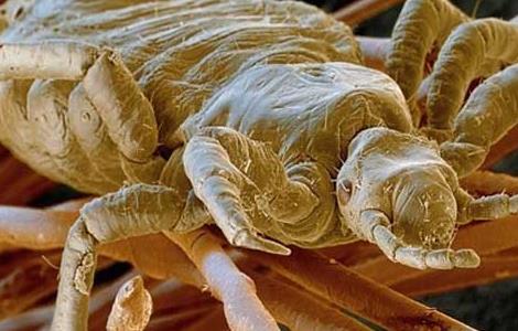 虱子咬有什么症状（虱子咬了有什么症状）