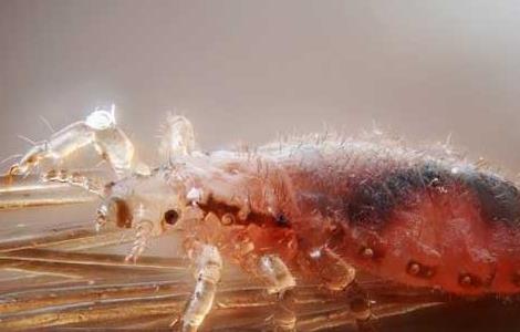 去虱子最简单的方法（去虱子最简单的方法视频）