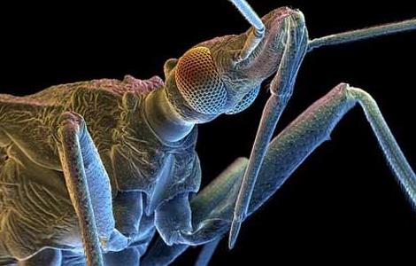 去阴虱子最简单的方法 去阴虱子最简单的方法图片