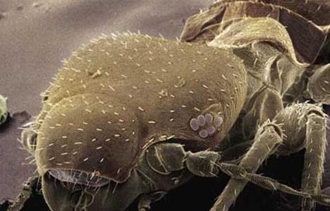 虱子是怎么产生的 虱子是怎么产生的,怎么去除虱子