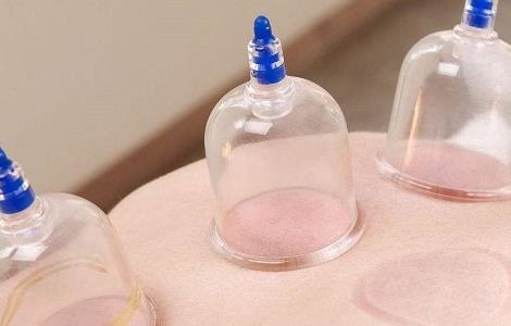 拔火罐的好处和坏处 腿部拔火罐的好处和坏处