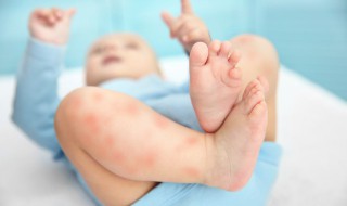 一到冬天晚上身上就痒怎么回事 冬天每天晚上身上很痒