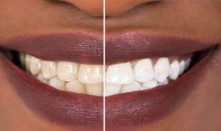 盐水漱口的好处和坏处（晚上盐水漱口的好处和坏处）