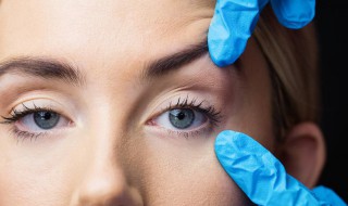 眼睛下面有细纹怎么去除（眼睛下面有细纹怎么去除做什么医美项目）