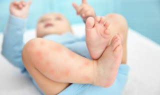 新生儿驱蚊小妙招有哪些 最安全的新生婴儿驱蚊方式