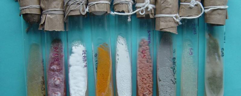 菌种保藏的原理，菌种保藏方法 菌种保藏的主要原理及其方法有哪些?