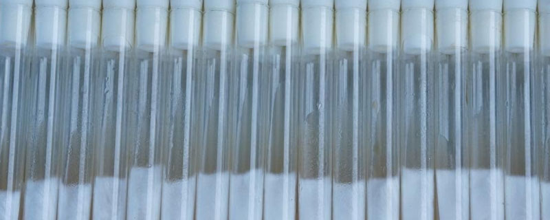 菌种分离的一般过程 菌种分离的一般过程包括哪些