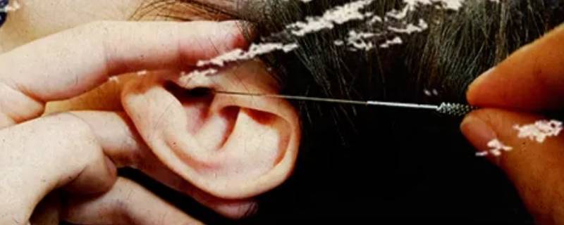 什么是采耳(什么是采耳店)